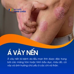 Á vảy nến 1
