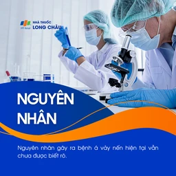 Á vảy nến 2