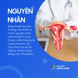 Nguyên nhân băng huyết sau sinh gồm đờ tử cung, chấn thương, sót nhau, rối loạn đông máu