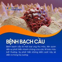 Bệnh bạch cầu là ung thư máu do sự phát triển bất thường và mất kiểm soát của tế bào máu trong tủy xương.