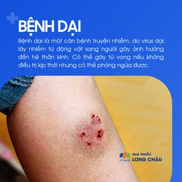 Bệnh dại do virus, lây từ động vật sang người, có thể tử vong nếu không điều trị