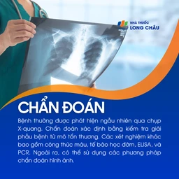 Bệnh Dirofilariasis 5