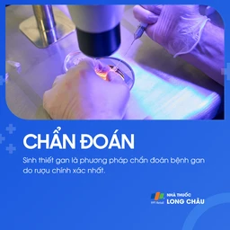 Bệnh gan do rượu 5