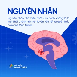 Bệnh khổng lồ 3