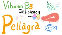 Bệnh Pellagra là bệnh gì? Một số điều cần biết về bệnh Pellagra 1