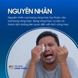 Do co kéo võng mạc, thanh dịch, không liên quan vết rách