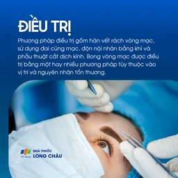 Hàn vết rách, tiêm khí, phẫu thuật cắt dịch kính – tùy nguyên nhân và vị trí tổn thương