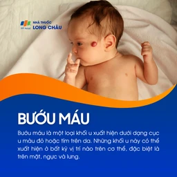 Bướu máu 1