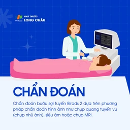 Bướu sợi tuyến vú Birads 3 5
