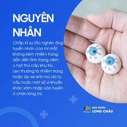 Chắp do tắc tuyến nhờn, không nhiễm trùng. Lẹo do vi khuẩn gây viêm, thường là tụ cầu khuẩn