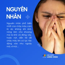 Không khí khô, nóng, ngoáy mũi, xì mũi mạnh… là nguyên nhân phổ biến gây chảy máu cam