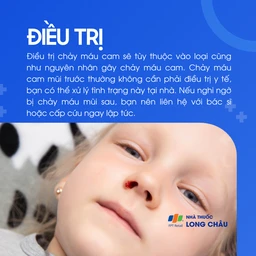 Với máu cam mũi trước, bạn có thể xử lý tại nhà. Máu mũi sau cần khám ngay nếu nghi ngờ nặng