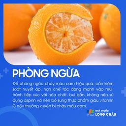Giữ ẩm không khí, hạn chế tác động vào mũi, bổ sung vitamin C, kiểm soát huyết áp để ngừa chảy máu cam