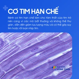 Cơ tim hạn chế 1