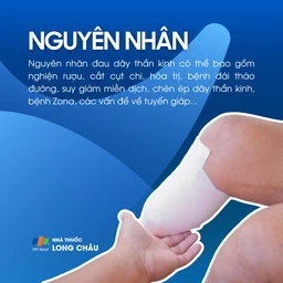 Đau dây thần kinh 3