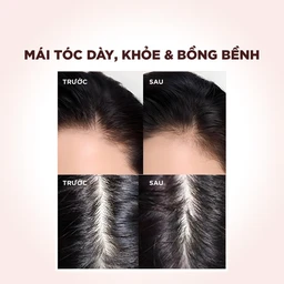 Dầu gội L'oreal full resist purifying giảm gãy rụng tóc giúp tóc chắc khỏe (440ml) 5