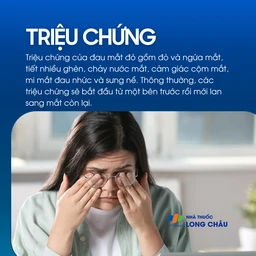 Triệu chứng đau mắt đỏ gồm đỏ mắt, ngứa, chảy nước mắt và sưng mi – dấu hiệu thường gặp của viêm kết mạc