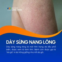 Dày sừng nang lông 1