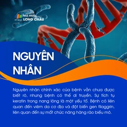 Dày sừng nang lông 3