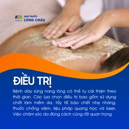 Dày sừng nang lông 6