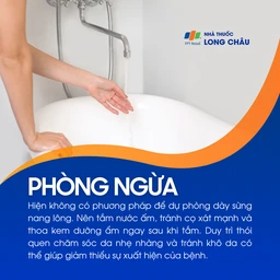 Dày sừng nang lông 7