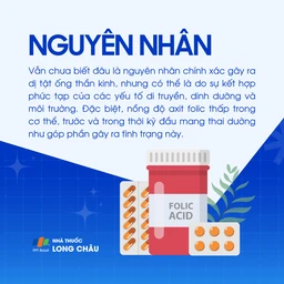 Dị tật ống thần kinh  3
