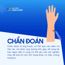 Dị ứng thuốc 5