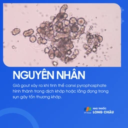 Giả gout 3