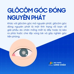 Glôcôm góc đóng nguyên phát 1