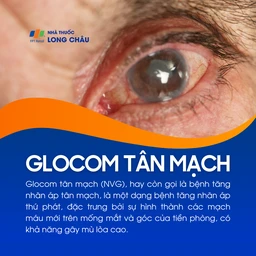 Glocom tân mạch 1