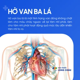 Hở van ba lá 1