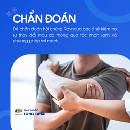 Hội chứng raynaud 5