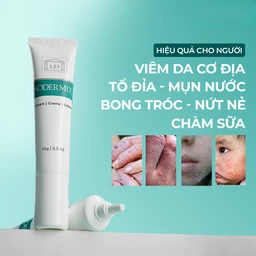 Kem bôi viêm da cơ địa Sodermix cream 15g giảm ngứa, bong tróc, vảy nến, tổ đỉa, viêm da do xạ trị 4