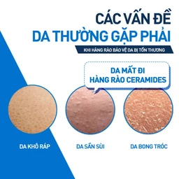 Kem dưỡng ẩm cho da khô CeraVe Moisturising Cream (50ml)