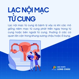 Lạc nội mạc tử cung 1