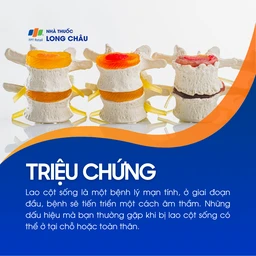 Lao cột sống 2
