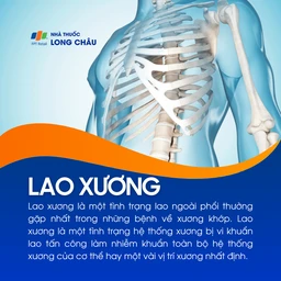 Lao xương 1