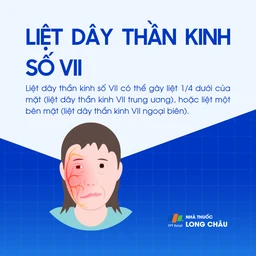 Liệt dây thần kinh số VII 1