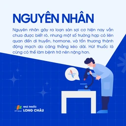Loạn sản sợi cơ 3