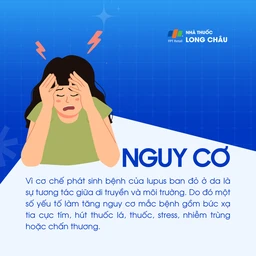 Lupus ban đỏ dạng đĩa 4
