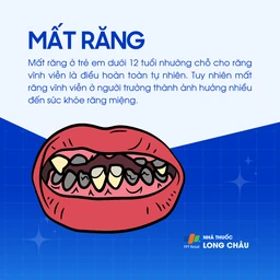 Mất răng 1