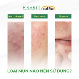 Miếng dán mụn Elaband Hydrodot Teatree (23 miếng) hút dịch mụn, giảm sưng viêm 4