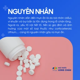 Mụn ẩn 3