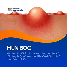 Mụn bọc 1