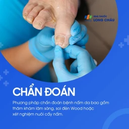 Thăm khám lâm sàng, soi đèn Wood hoặc làm xét nghiệm nuôi cấy nấm để xác định bệnh