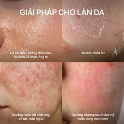 Kem bôi Neo Aqua cấp ẩm, dịu da, giúp da mịn màng (50g) 5