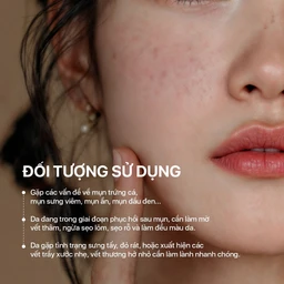 Gel Nghệ NeoCurma giảm mụn, ngừa sẹo, mờ vết thâm (20g) 4