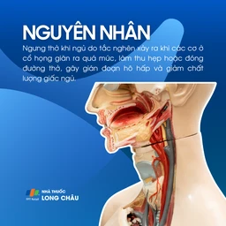 Ngưng thở khi ngủ do tắc nghẽn 3