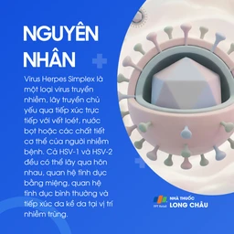 Nhiễm Herpes simplex 3