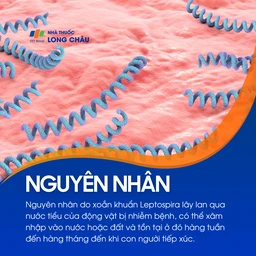 Nhiễm Leptospira 3